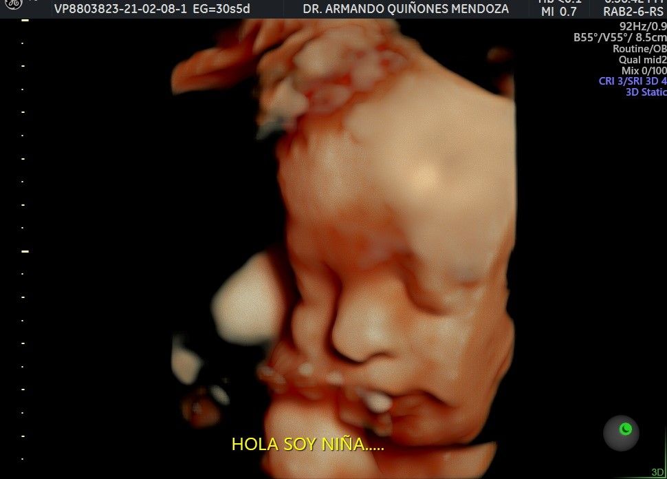 Armando Quiñones Mendoza-16