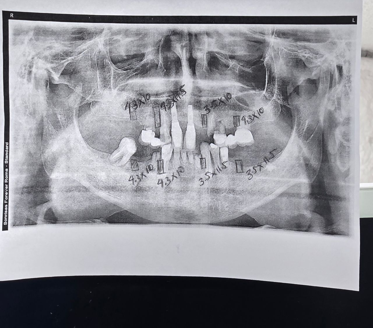 Edgardo Caballero Dávila-11