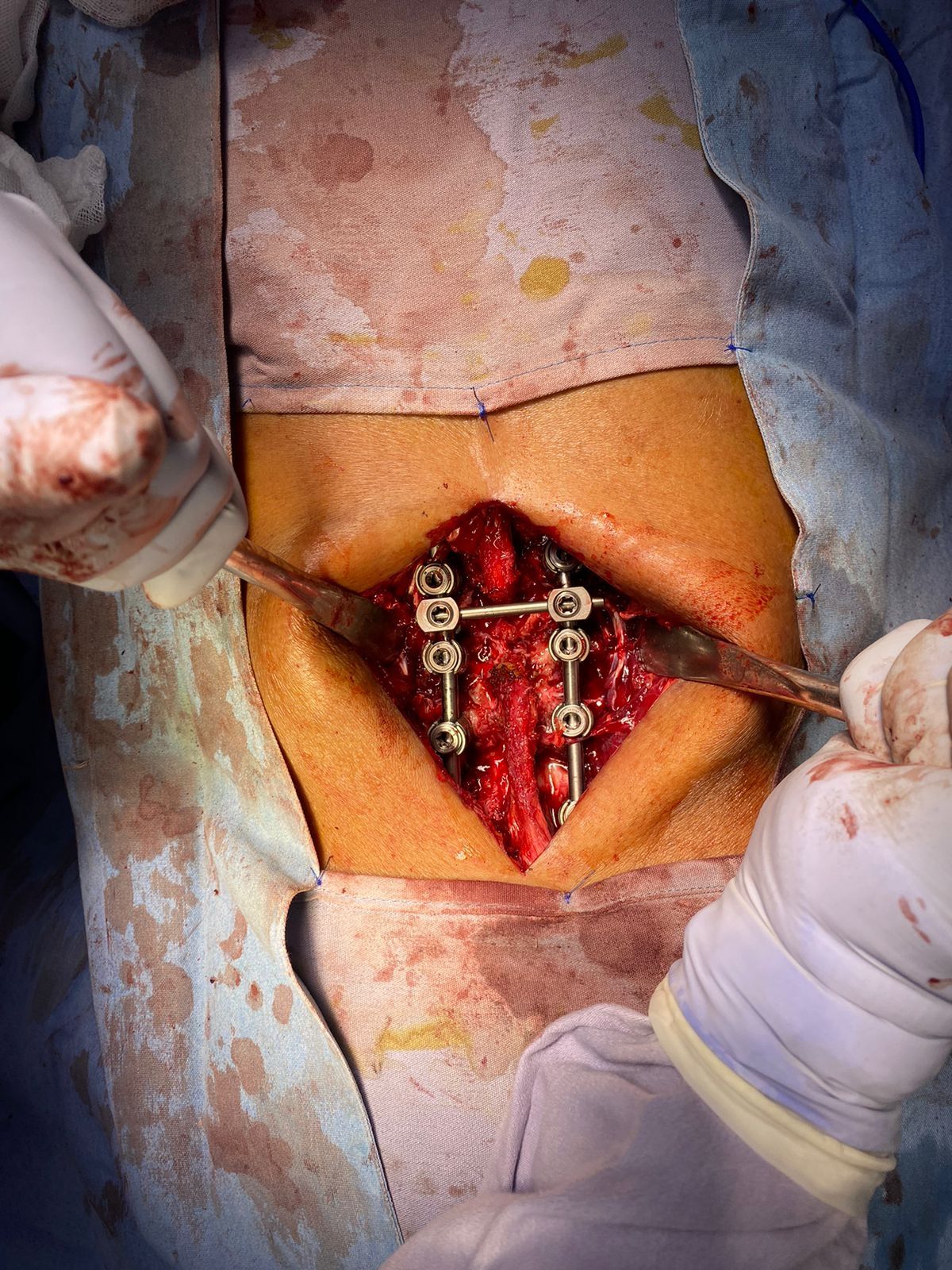 Emmanuel Bolaños Cortes-1