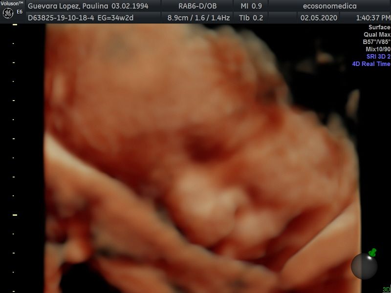 Héctor Bernardo Acevedo Manrique-24