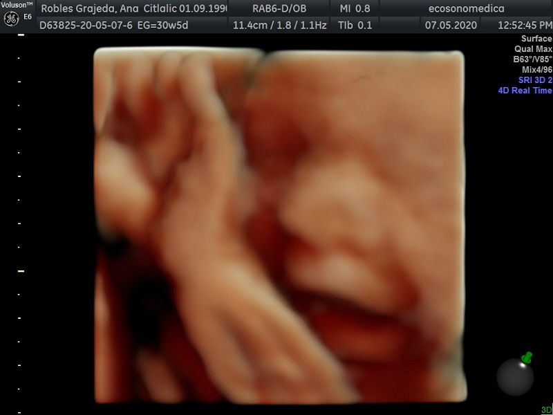 Héctor Bernardo Acevedo Manrique-13