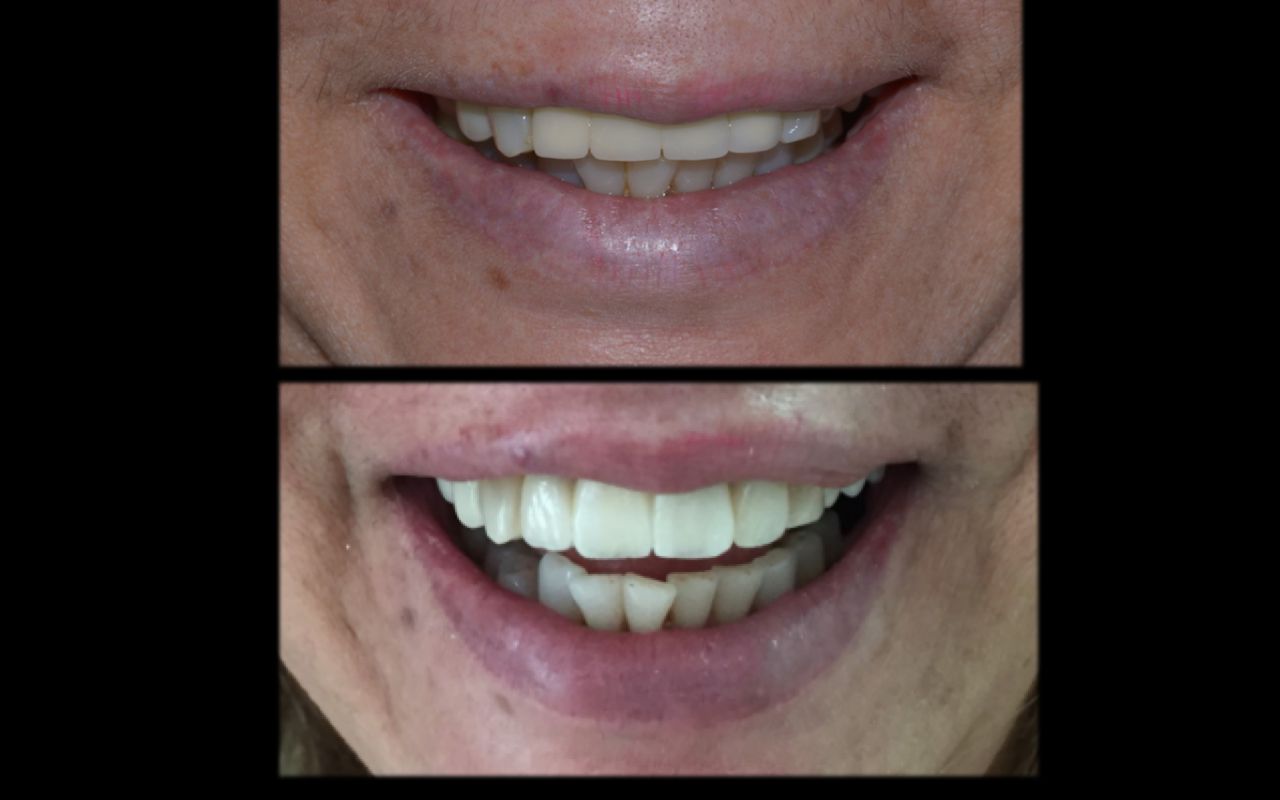 María Fernanda González Gastelum-13