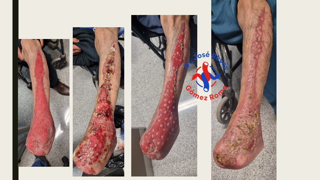 José Reyes Gómez Romo-3