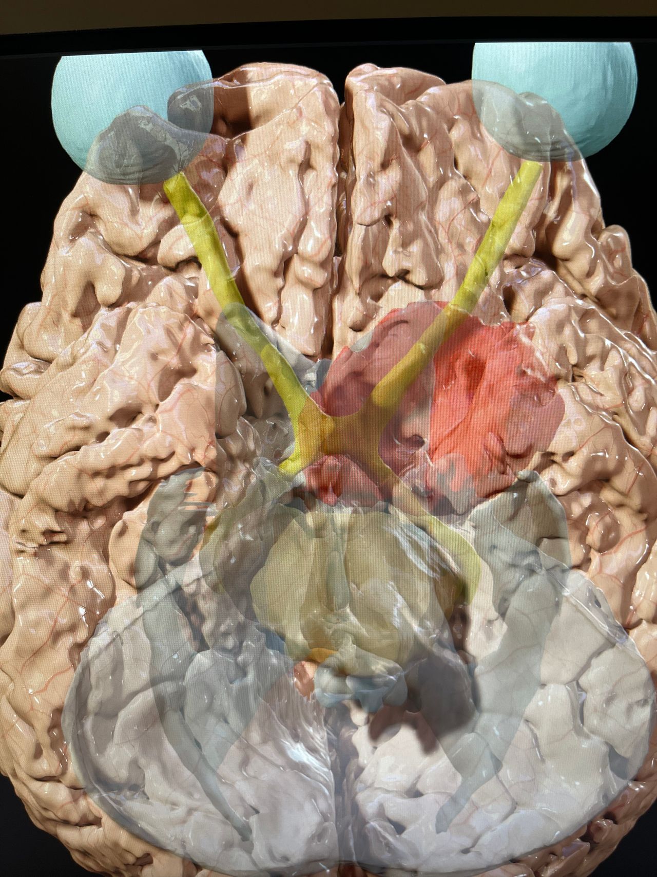 Juan Antonio Alvaro Heredia-0