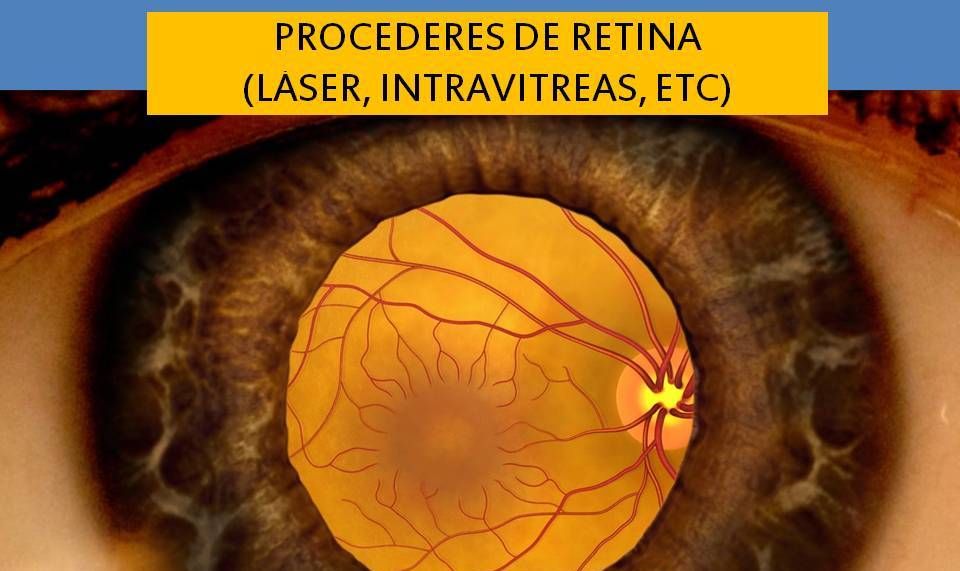 Armando Capote Cabrera-5