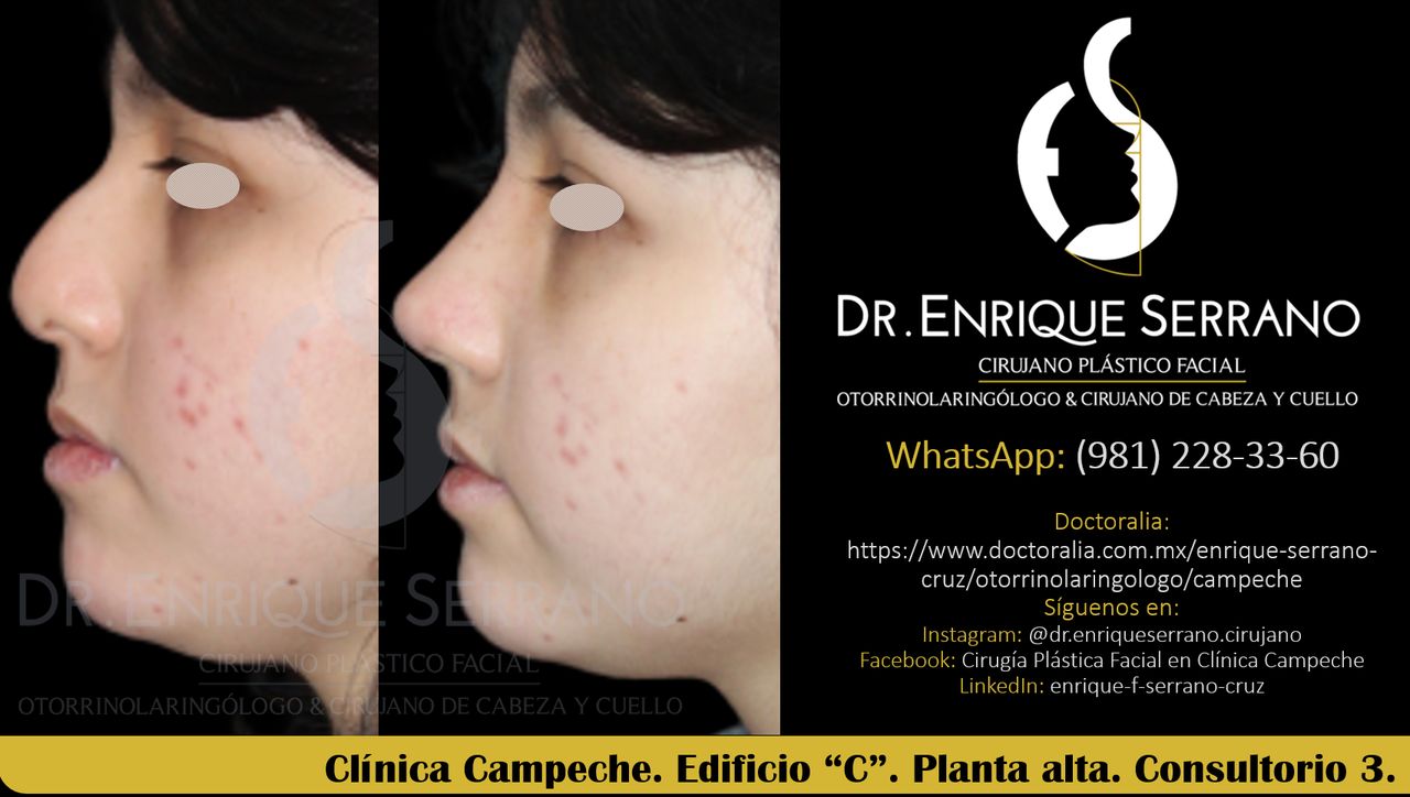 Enrique Serrano Cruz-68