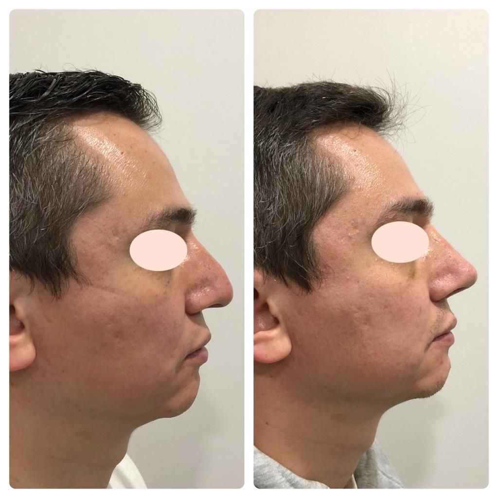 Carola Berenice Curiel Davalos-19