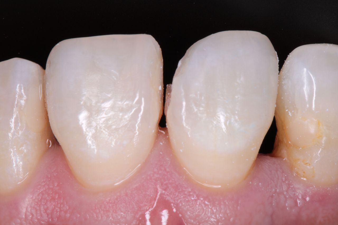 David Alan Escamilla Álvarez-16