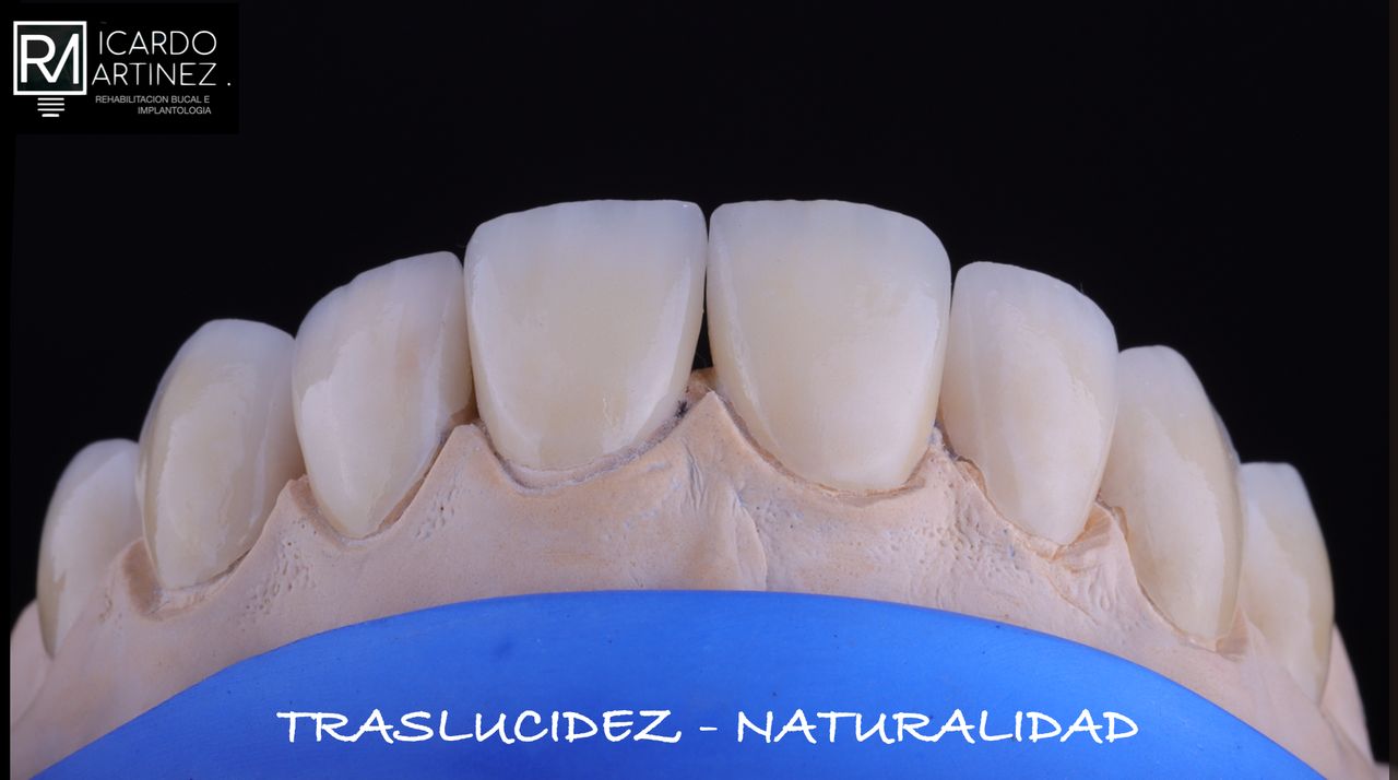 J. Ricardo Martínez-9