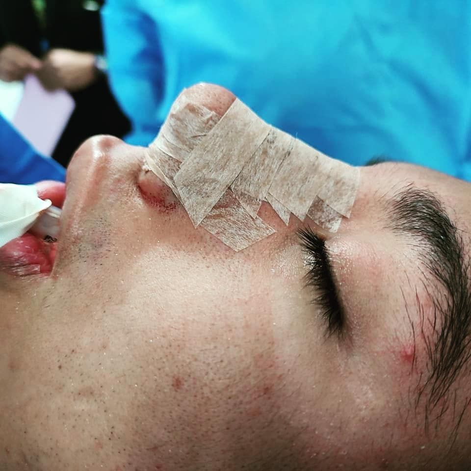 Juan Carlos Pérez Cancino-3