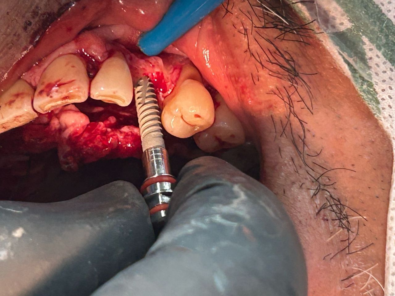 Jair Contreras García-62