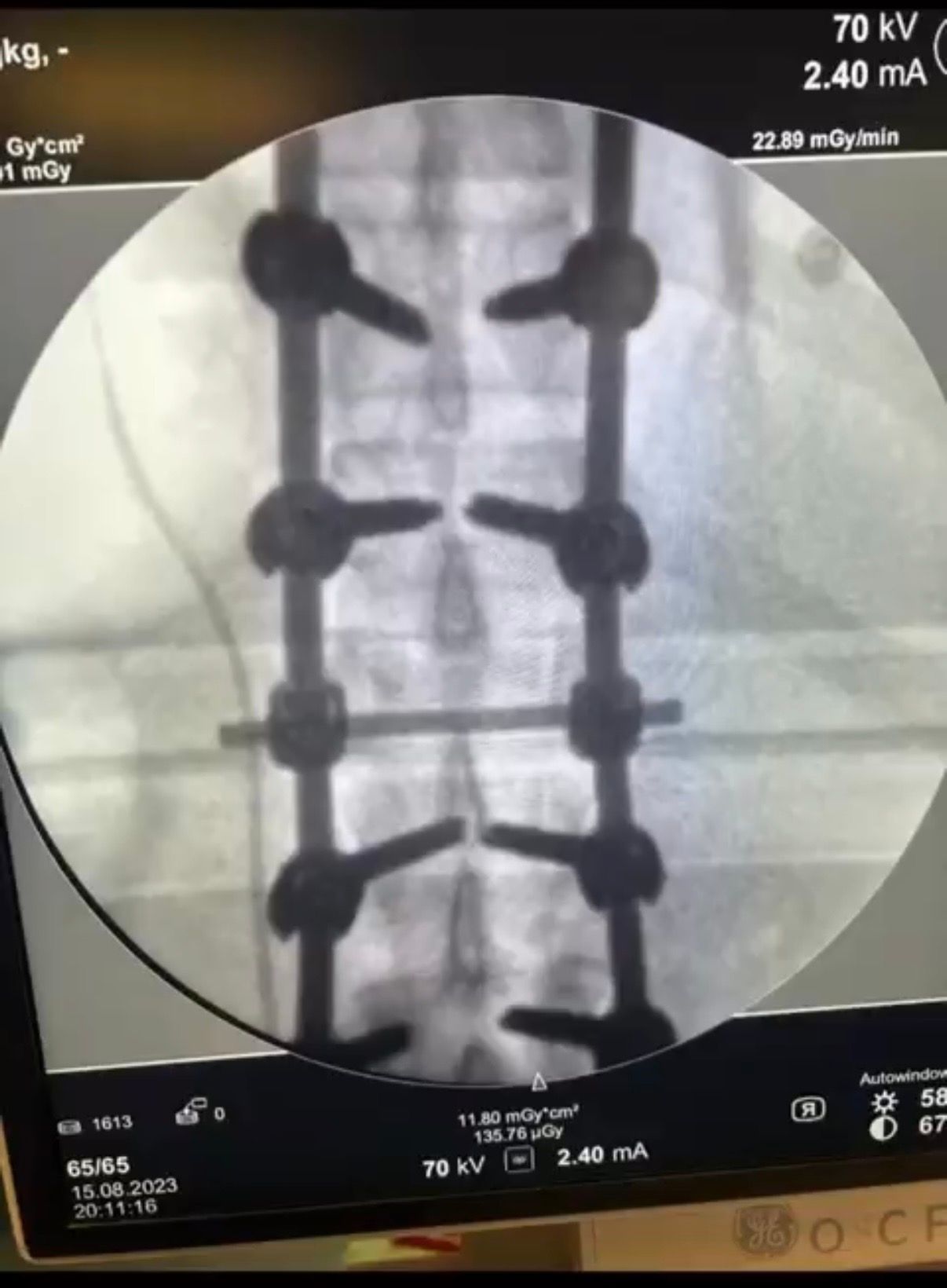 Luis Armando Martínez Benito-12