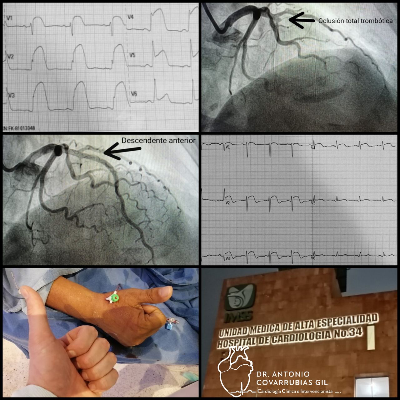 Antonio Covarrubias Gil-34