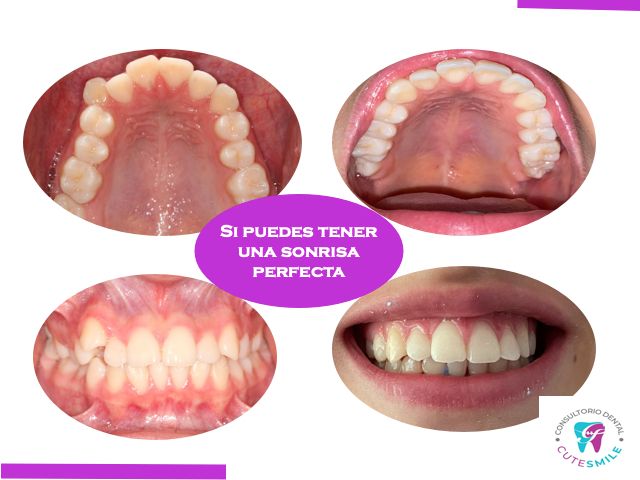 Georgina Zurita Rdz-2