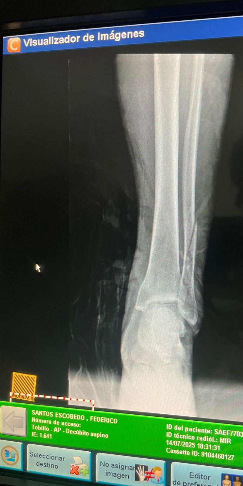 Max Georges Sainte Bernal-11