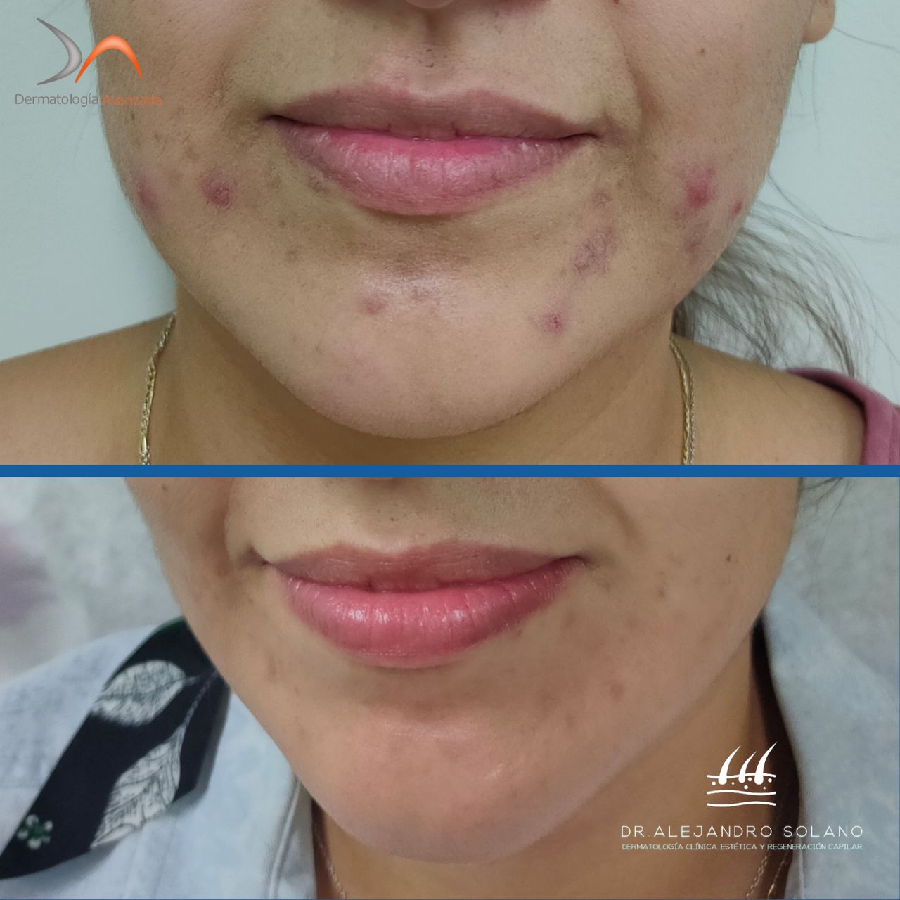 Oscar Alejandro Solano Anguiano-11