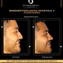 Enrique Serrano Cruz-25