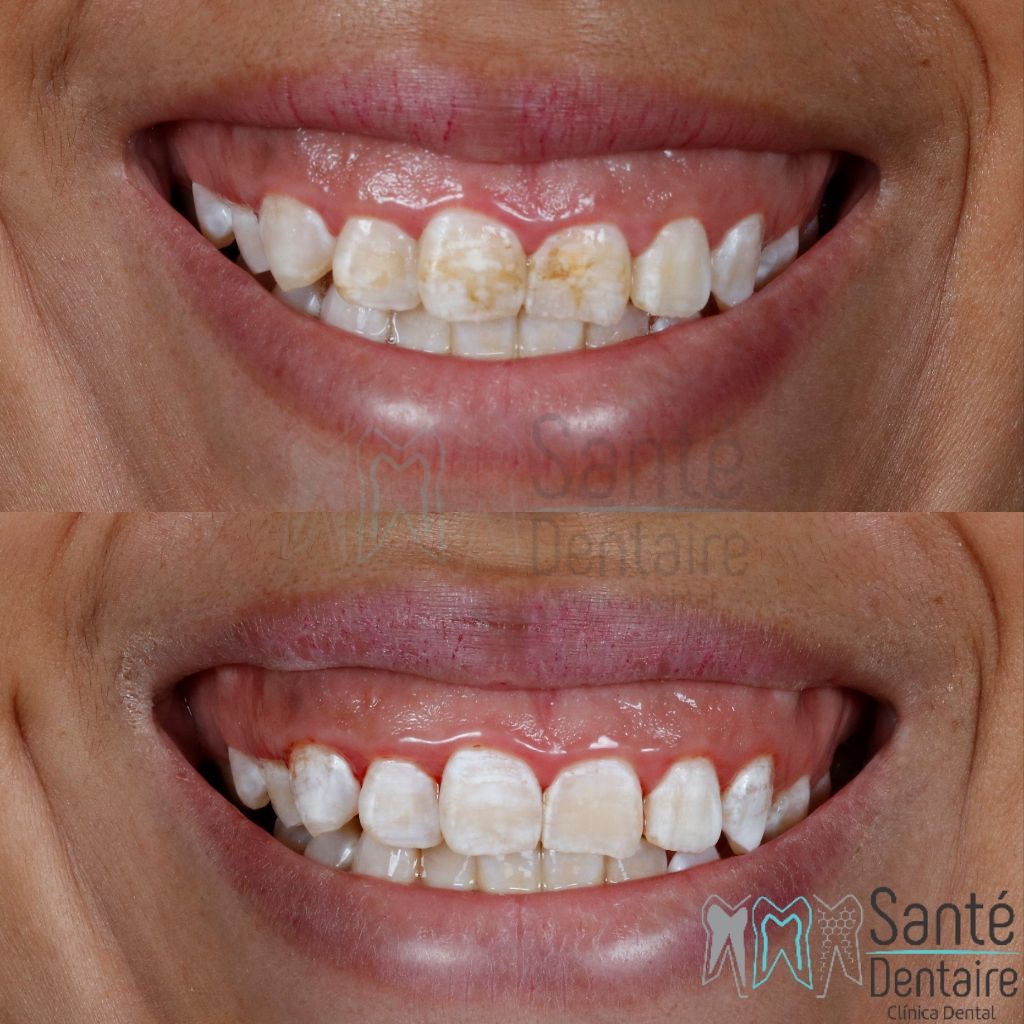 Daniel Oñate Robledo-24