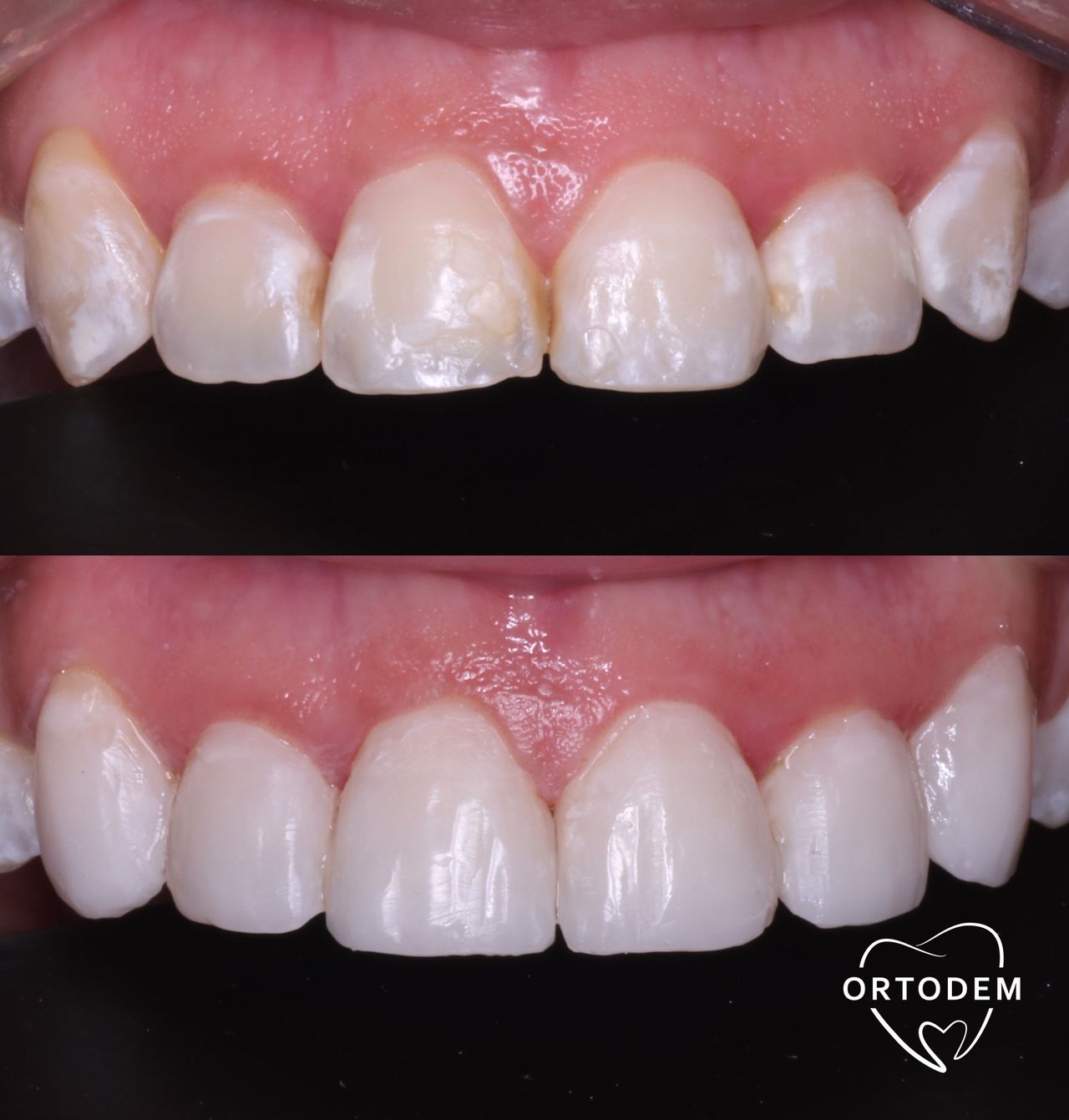 Elizabeth Morelos Morales-26