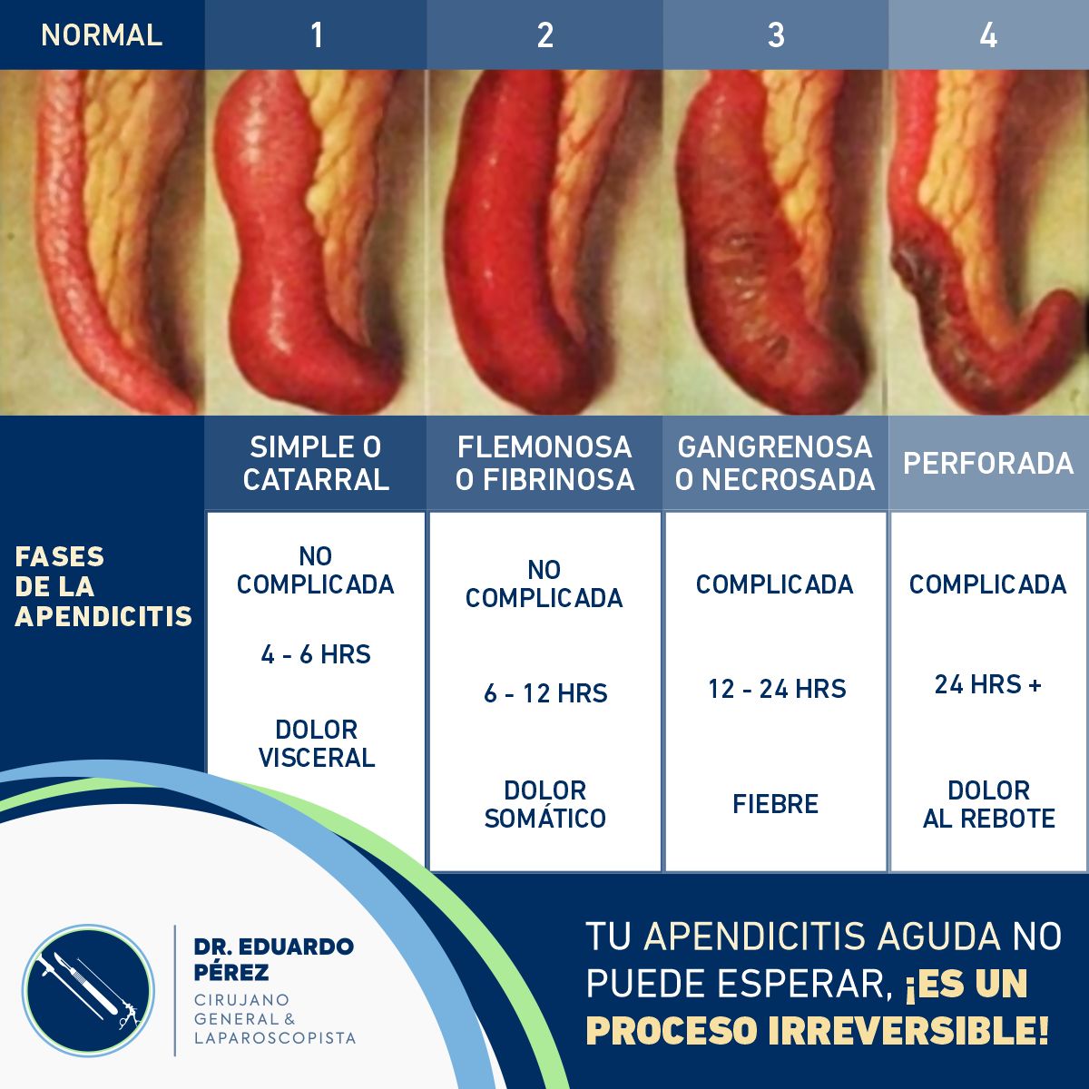 José Eduardo Pérez Vásquez-20