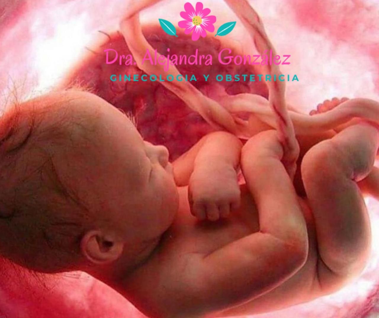 Alejandra Alizbeth Gonzalez Carrillo-18