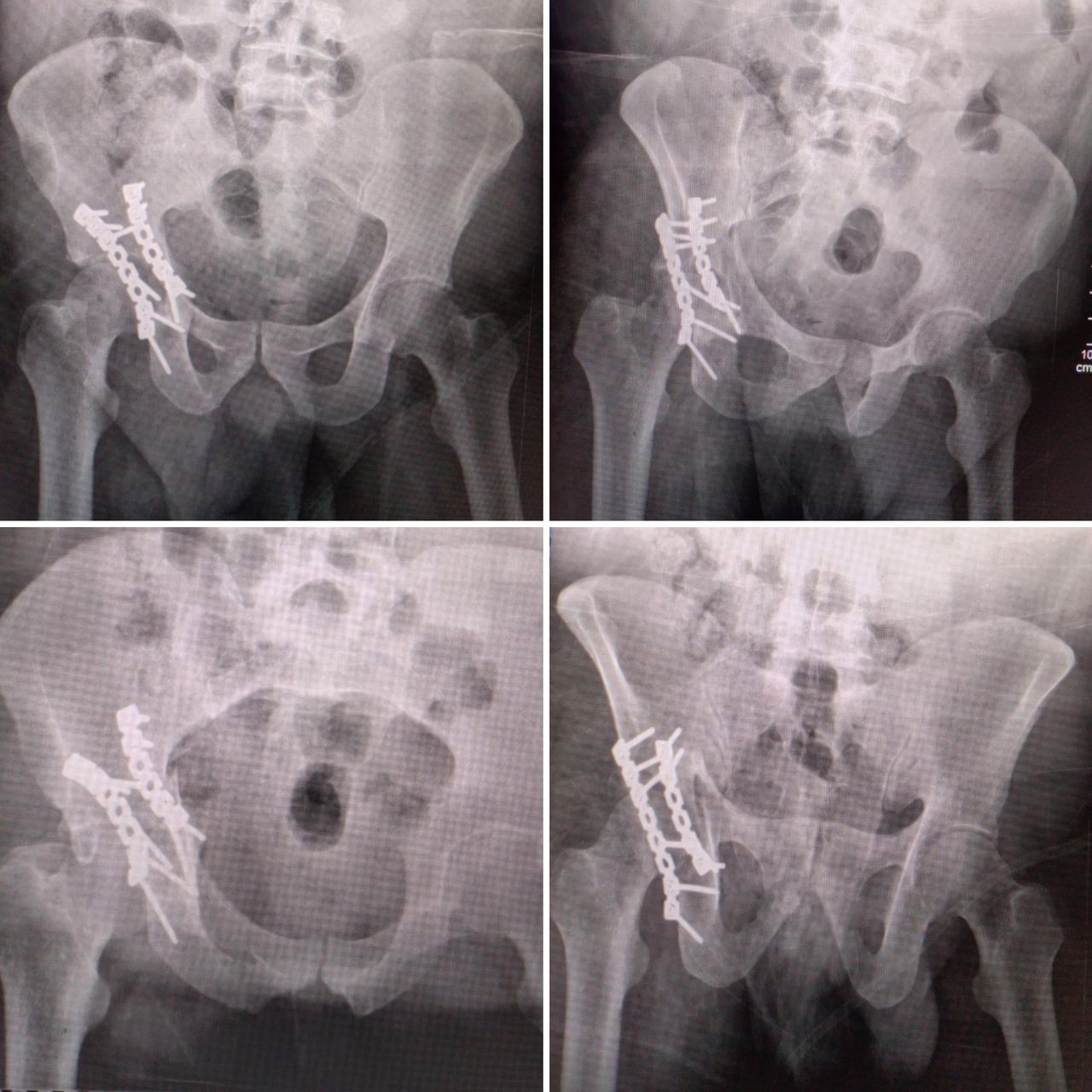 Jorge Manuel Valadez Soto-6