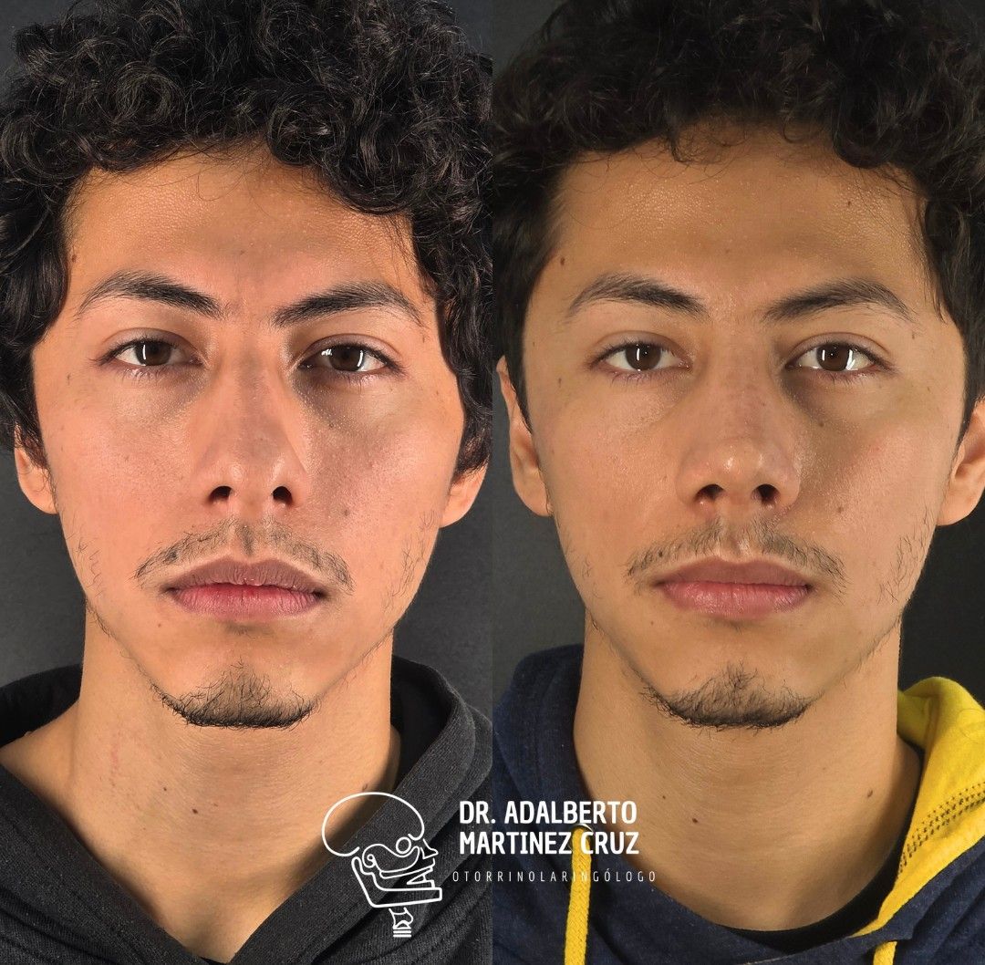 Adalberto Martínez Cruz-29