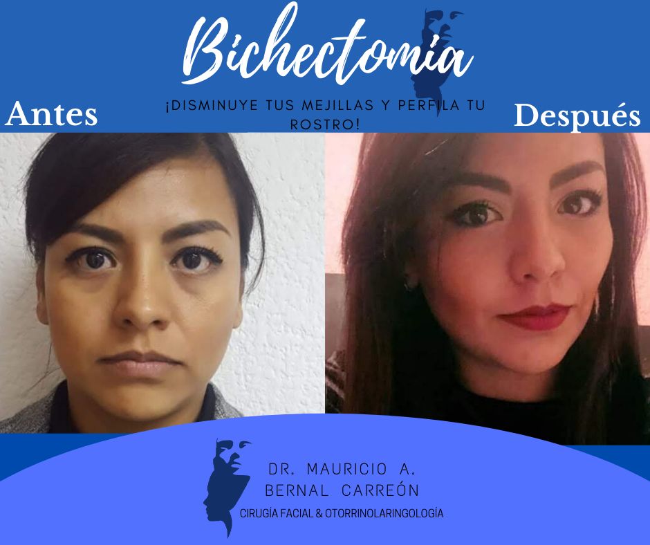 Mauricio Alejandro Bernal Carreon-7