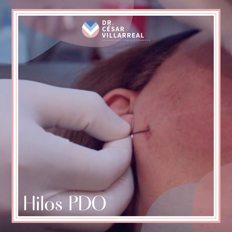 César Daniel Villarreal Villarreal-19