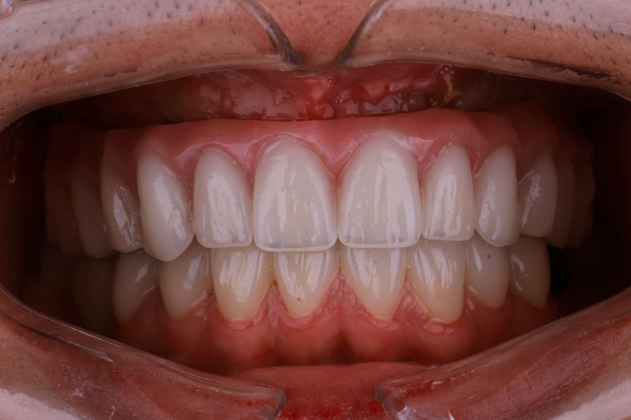 Josué Márquez Gómez-41