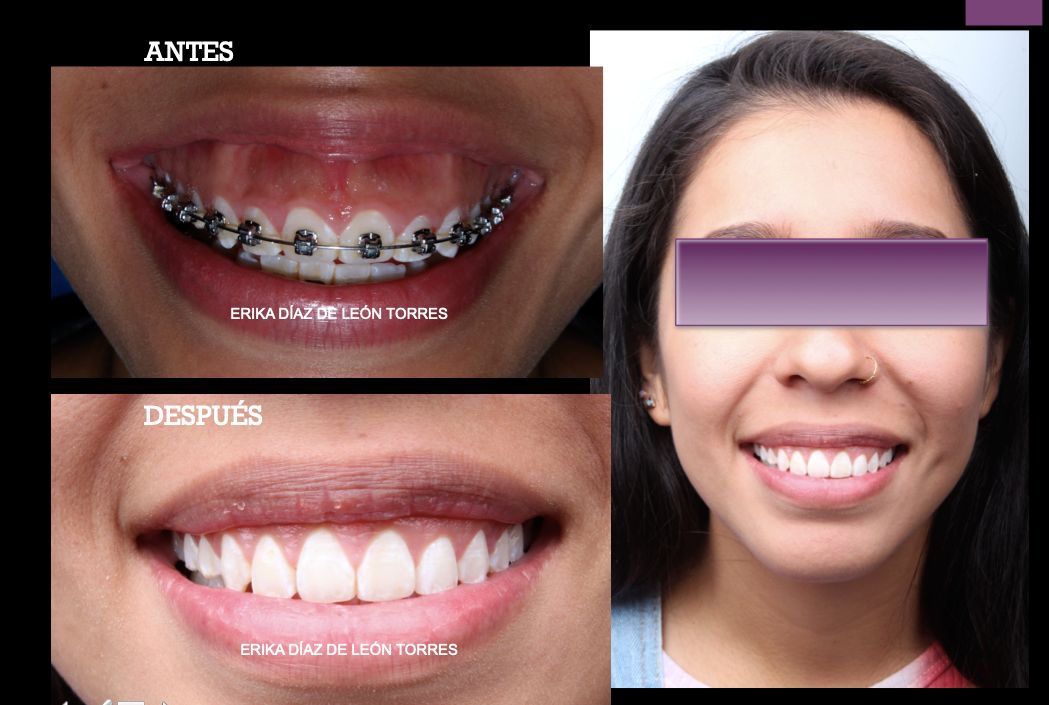 Erika Díaz De León Torres-20