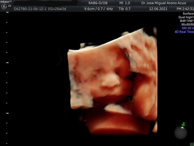 José Miguel Arano Acua-16