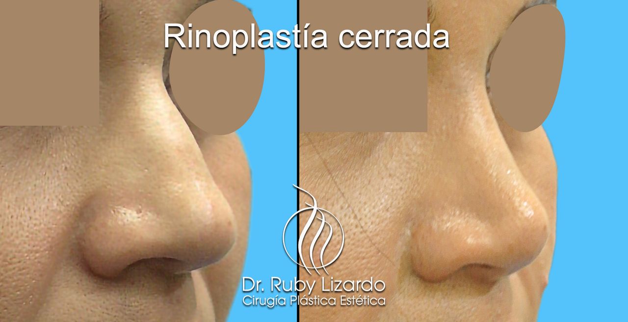 Ruby Lizardo Ramírez Robles-4