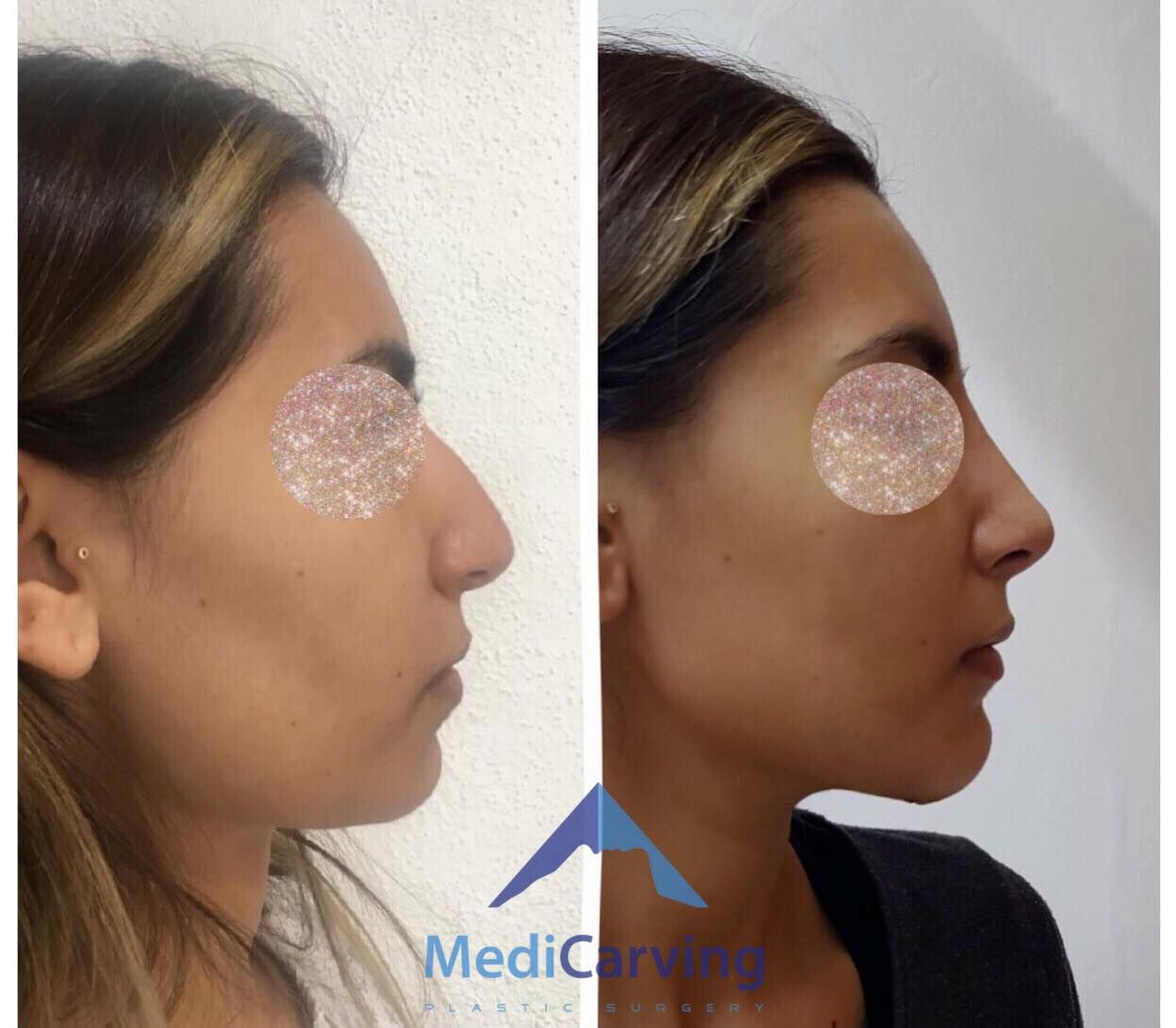 Rafael Velázquez Razo-7