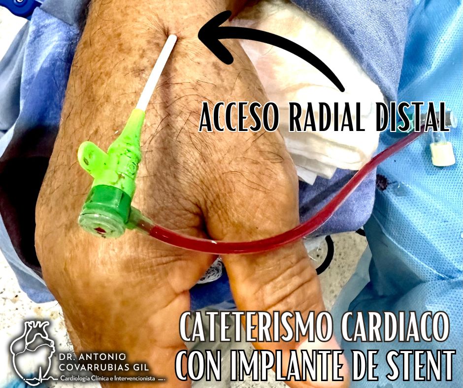 Antonio Covarrubias Gil-12