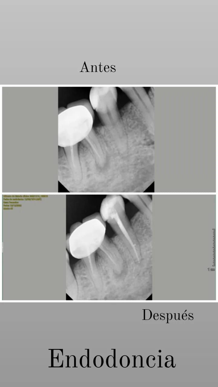 Zury Sarai Moreno Soto-42