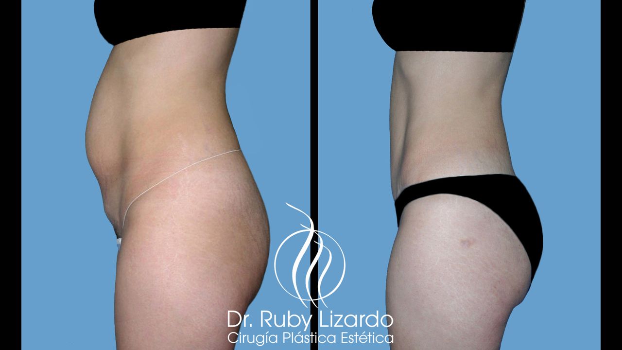 Ruby Lizardo Ramírez Robles-14