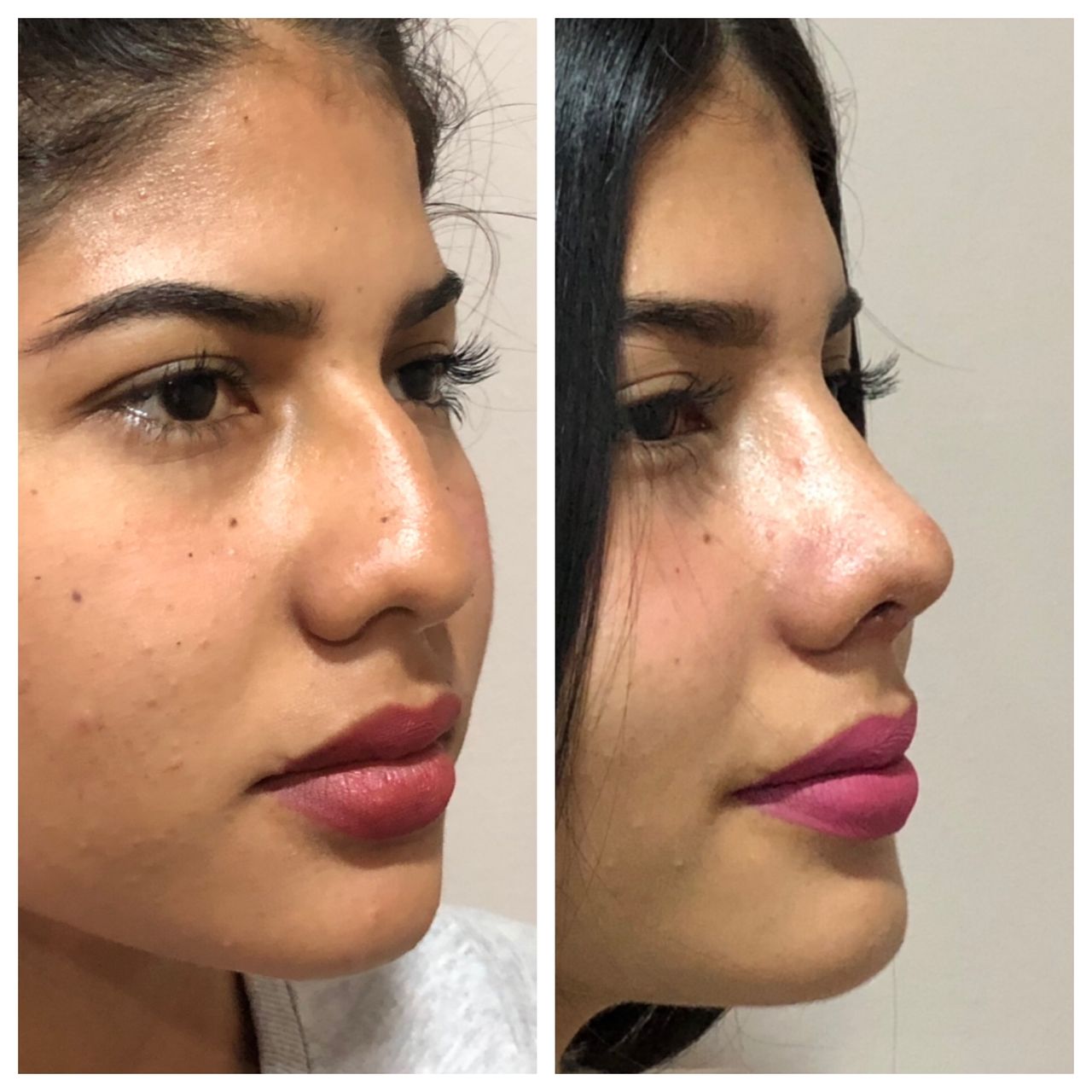 Alejandro Jimenez Garcia-11