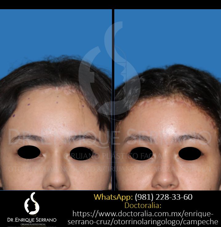 Enrique Serrano Cruz-42