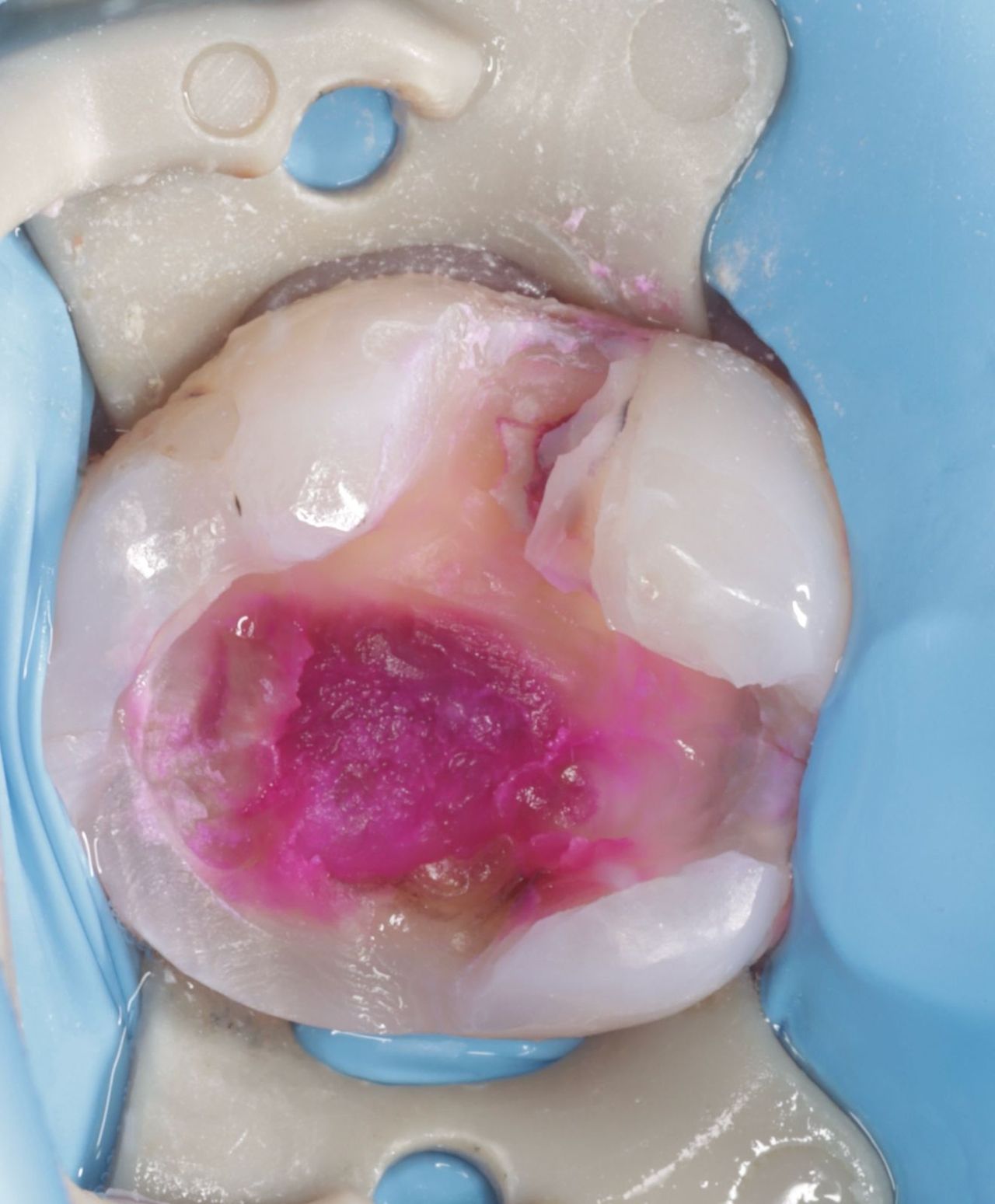 Fredy Alejandro Roblero Gónzalez-51