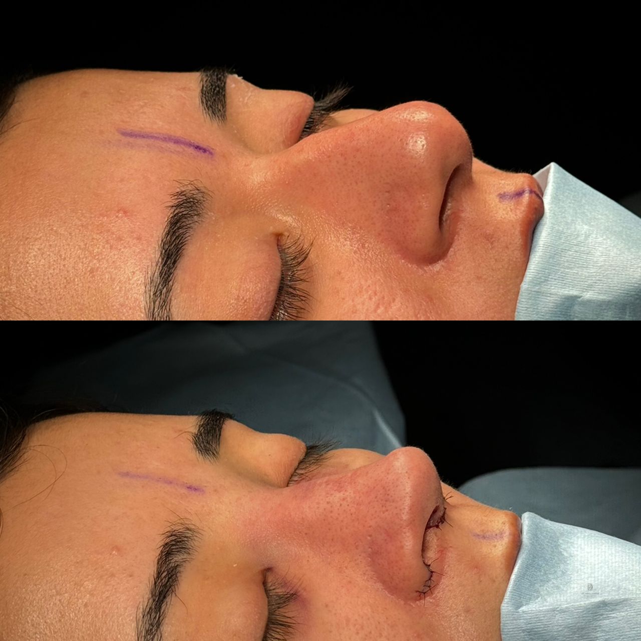 Angel Castro Urquizo-33