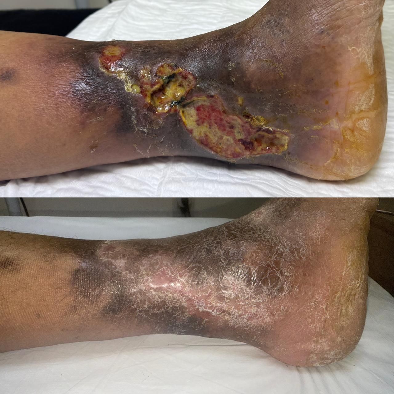 Jhonatan López González-66