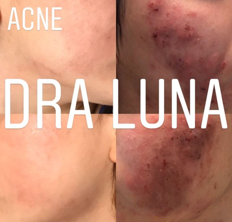 Virginia Susana Luna Magaña-13