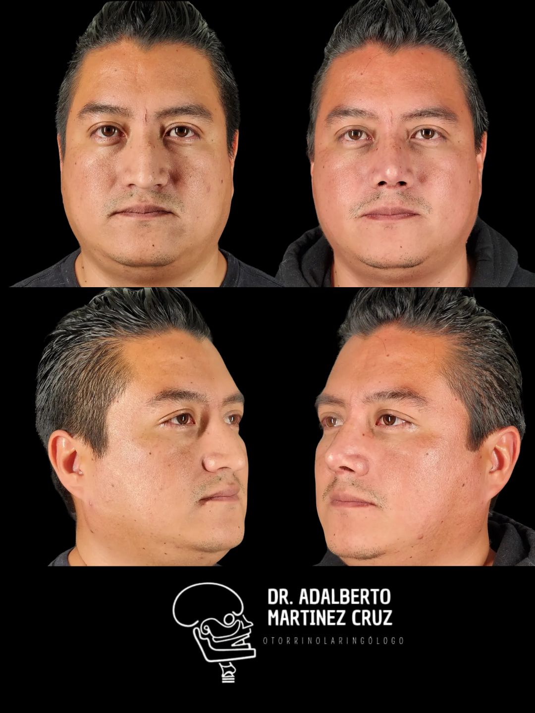 Adalberto Martínez Cruz-22