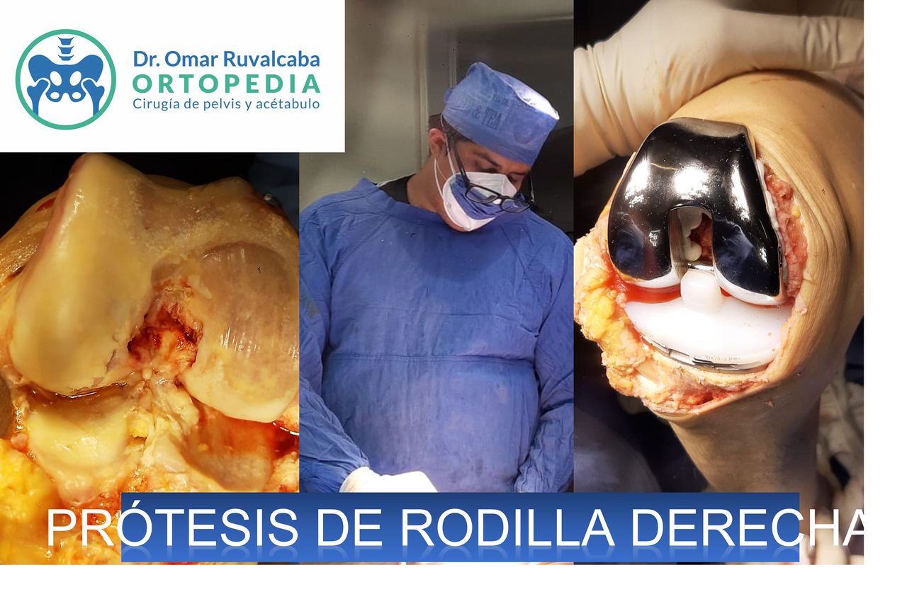 Omar Ruvalcaba Luna-19