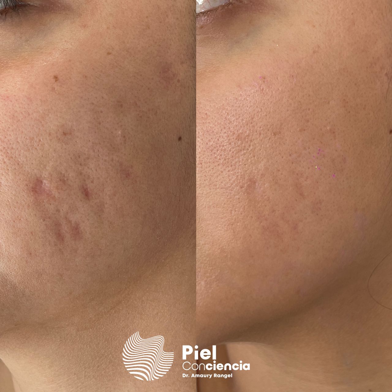 Víctor Amaury Rangel Avilés-15