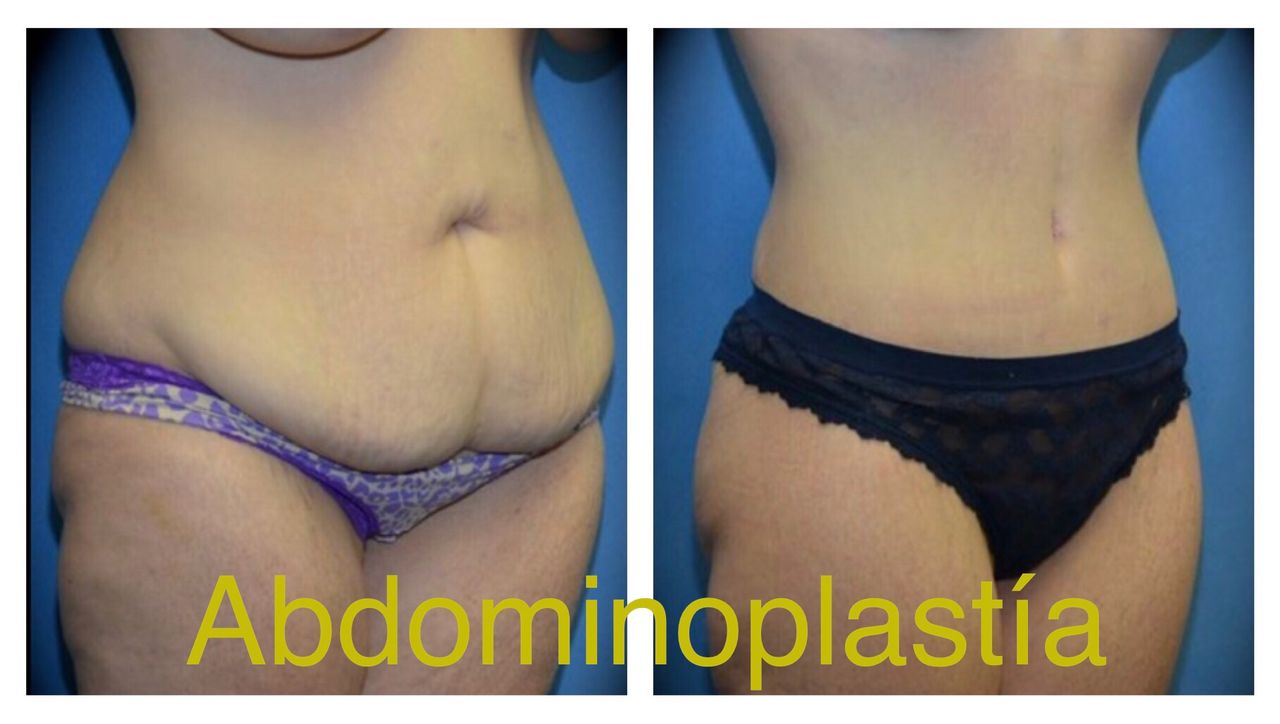 Ubaldo Carpinteyro Espín-14