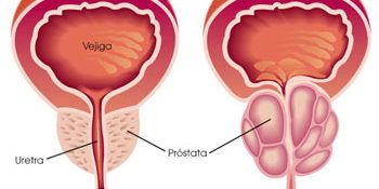 Pedro Enrique Martínez Constantino-15