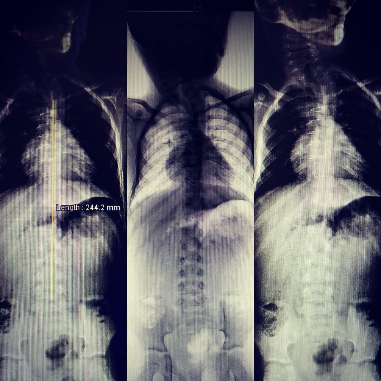 Alfonso Meza Vernis-72