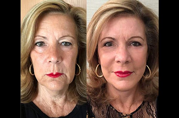 Edgar Ernesto Torres Mejía-25